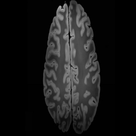 Un estudio sugiere que la conciencia no se encuentra en el cerebro, sino en su campo electromagnético