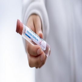 Por qué las pruebas PCR que se usan para diagnosticar la COVID-19 no dan falsos positivos por cualquier otro virus: solo detectan el SARS-CoV-2