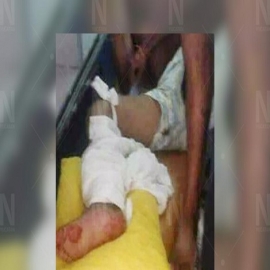 Espita: se pelea con su primo y le dispara con una escopeta