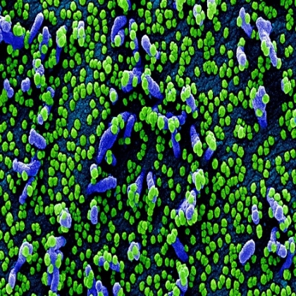 La comunidad de inteligencia de EEUU enfatiza que coronavirus no fue creado por el hombre
