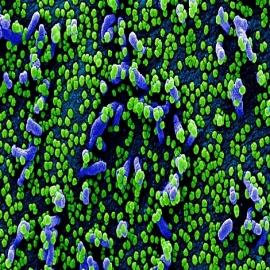 La comunidad de inteligencia de EEUU enfatiza que coronavirus no fue creado por el hombre