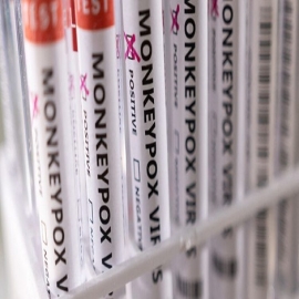 El primer brote global de viruela del mono ocurre en la semana exacta ‘predicha’ en la simulación de bioseguridad un año antes