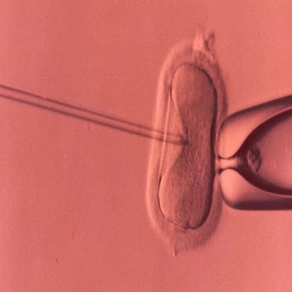 Francia aprueba proyecto de ley de Fertilización In Vitro para solteras y parejas lésbicas
