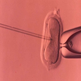 Francia aprueba proyecto de ley de Fertilización In Vitro para solteras y parejas lésbicas