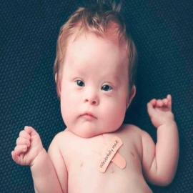 Este bebé con síndrome de Down sanó por intercesión de fundador de los Caballeros de Colón