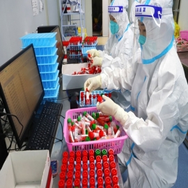 Alarma mundial: Científicos chinos experimentan con una cepa mutante de coronavirus que ataca el cerebro