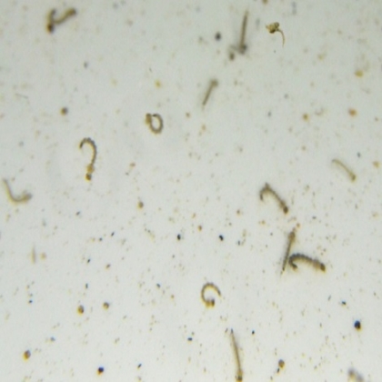 Casos de dengue aumentan; a la fecha hay 129 en Yucatán