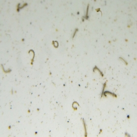 Casos de dengue aumentan; a la fecha hay 129 en Yucatán