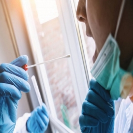 Test PCR darían gran número de FALSOS POSITIVOS cuando la cantidad de infectados es baja