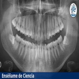 Descubrimiento científico revela que la causa del Alzheimer podría provenir de su boca