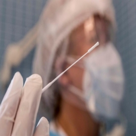Un estudio asegura que las PCR podrían detectar virus antiguos y dar falsos positivos de coronavirus