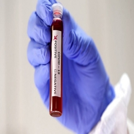 Científico revela cuáles son "el mejor amigo" y "el peor enemigo" del coronavirus