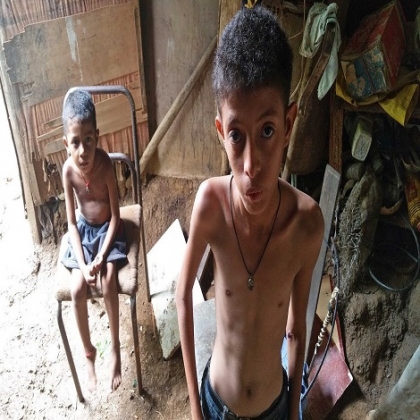 El hambre mata actualmente a 11 personas cada minuto en el mundo, revela un nuevo informe de la ONG Oxfam